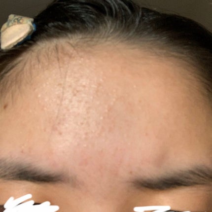 ノブ A アクネソープ/NOV/洗顔石鹸を使ったクチコミ(4枚目)