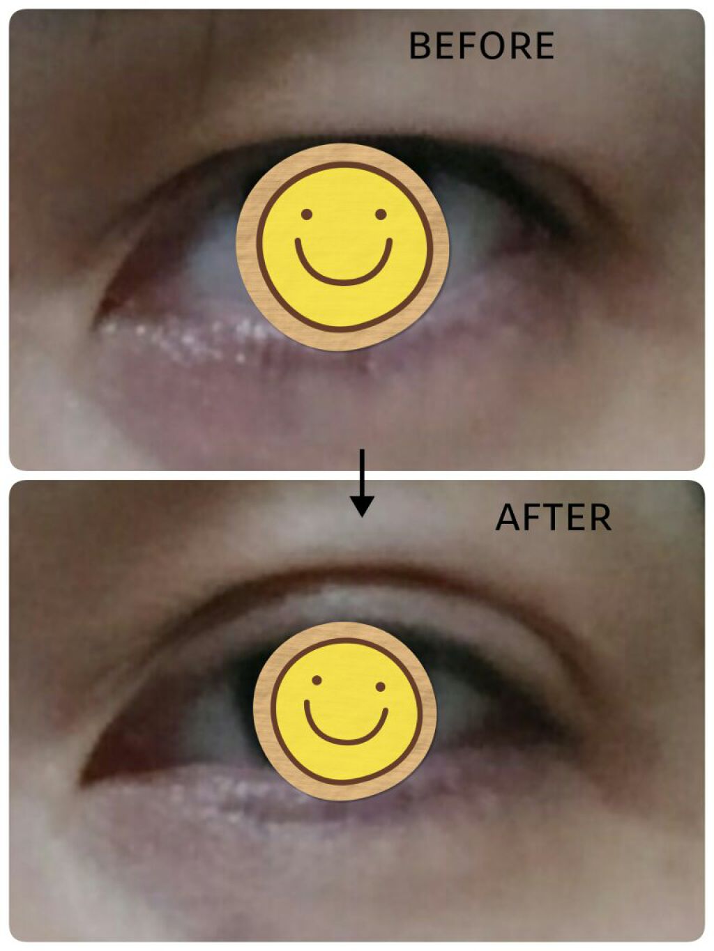 ワンダーアイリッドテープ Extra/D-UP/二重まぶた用アイテムを使ったクチコミ(5枚目)