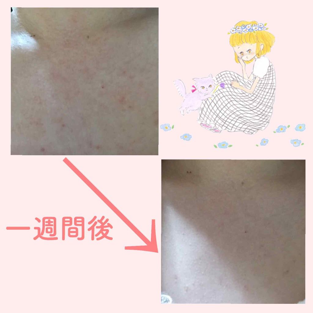 コラージュフルフル 泡石鹸/コラージュ/デリケートゾーンケアを使ったクチコミ(3枚目)