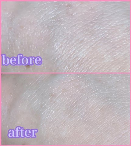 アクティブローション/AdryS/化粧水を使ったクチコミ(3枚目)