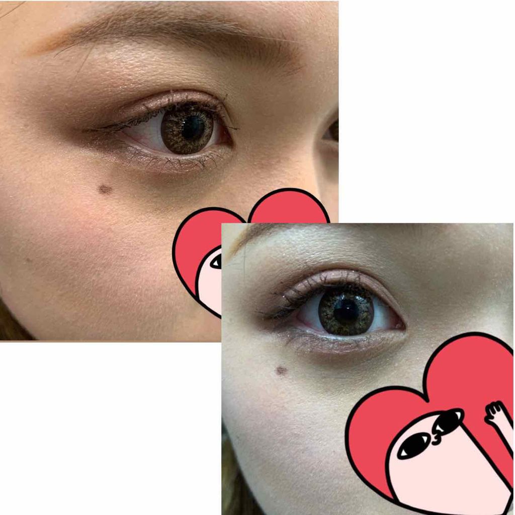 fatale/TwinkleEyes/カラーコンタクトレンズを使ったクチコミ（3枚目）