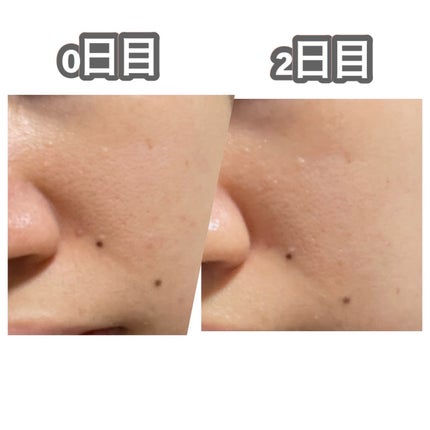 リードルS 100 2ステップマスク/VT/シートマスク・パックを使ったクチコミ(10枚目)