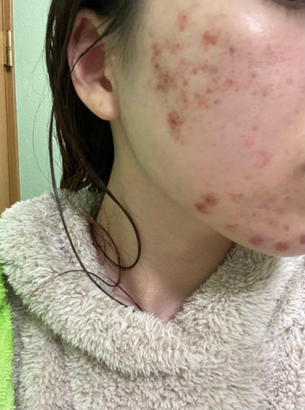 DHC マルチビタミン/DHC/美容サプリメントを使ったクチコミ(1枚目)