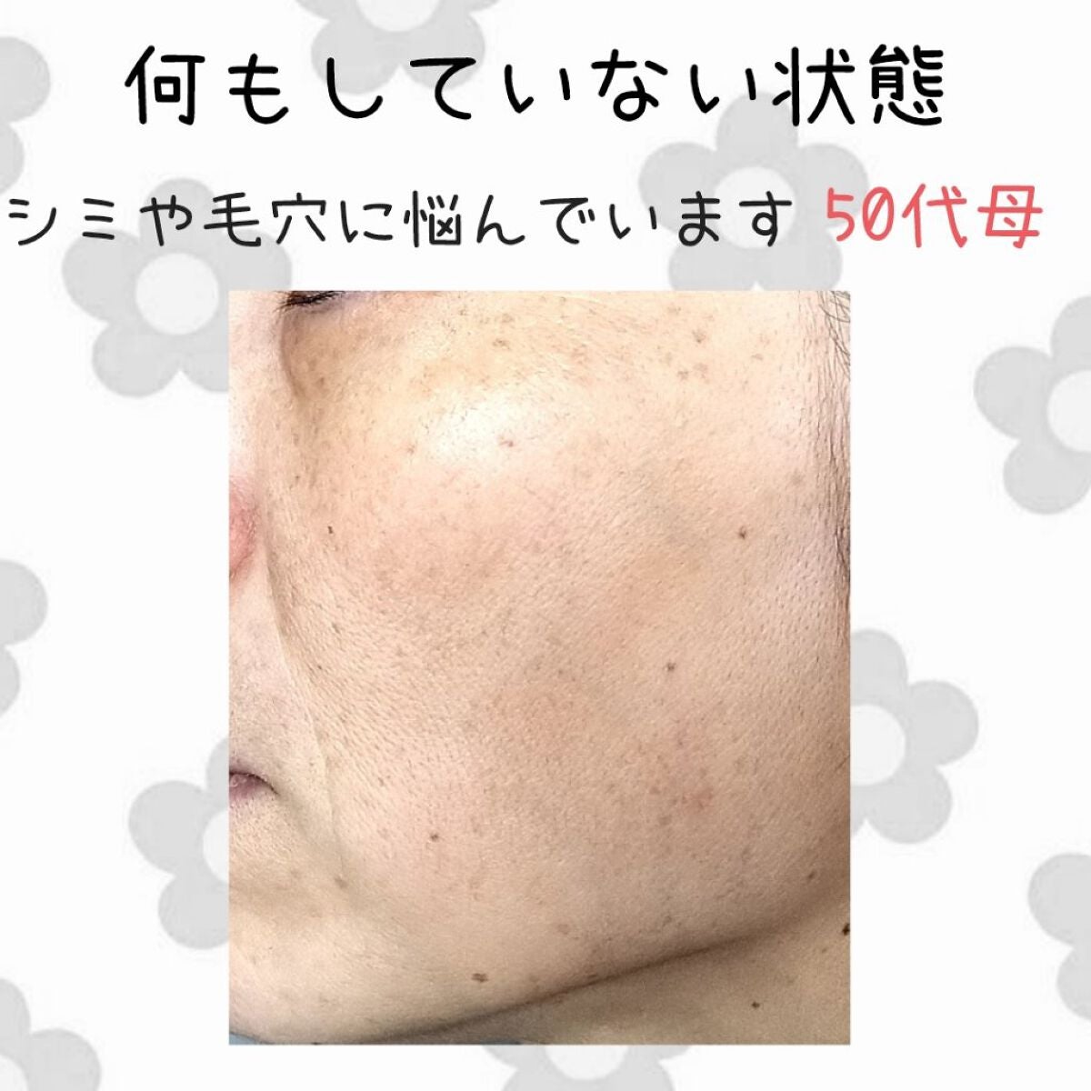 (旧)アンリミテッド ラスティング フルイド/shu uemura/リキッドファンデーションを使ったクチコミ(5枚目)