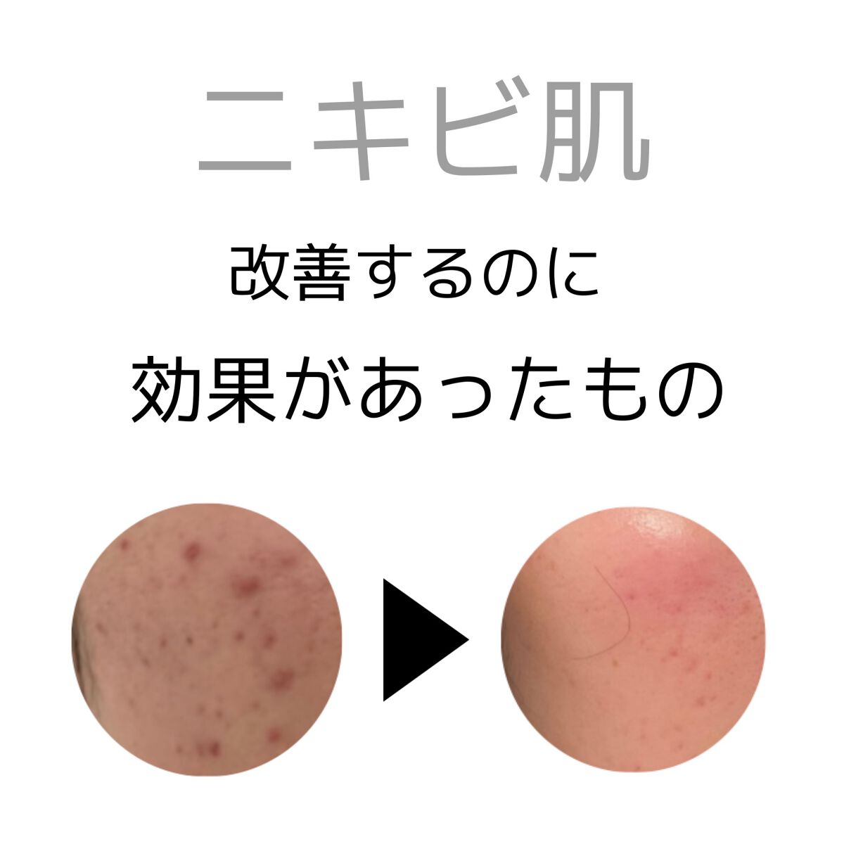 ゆ on LIPS 「投稿見て下さりありがとうございます。私が中学校の頃から悩み続け..」(1枚目)