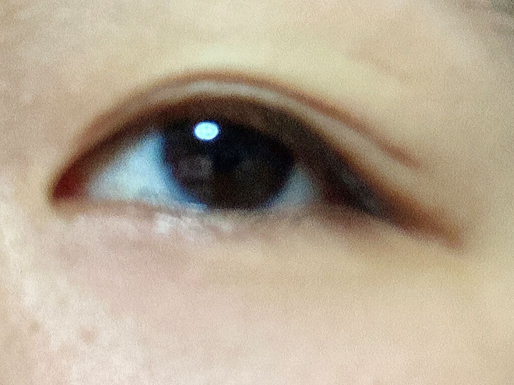 アイビューティー フィクサー WP/アストレア ヴィルゴ/二重まぶた用アイテムを使ったクチコミ（1枚目）