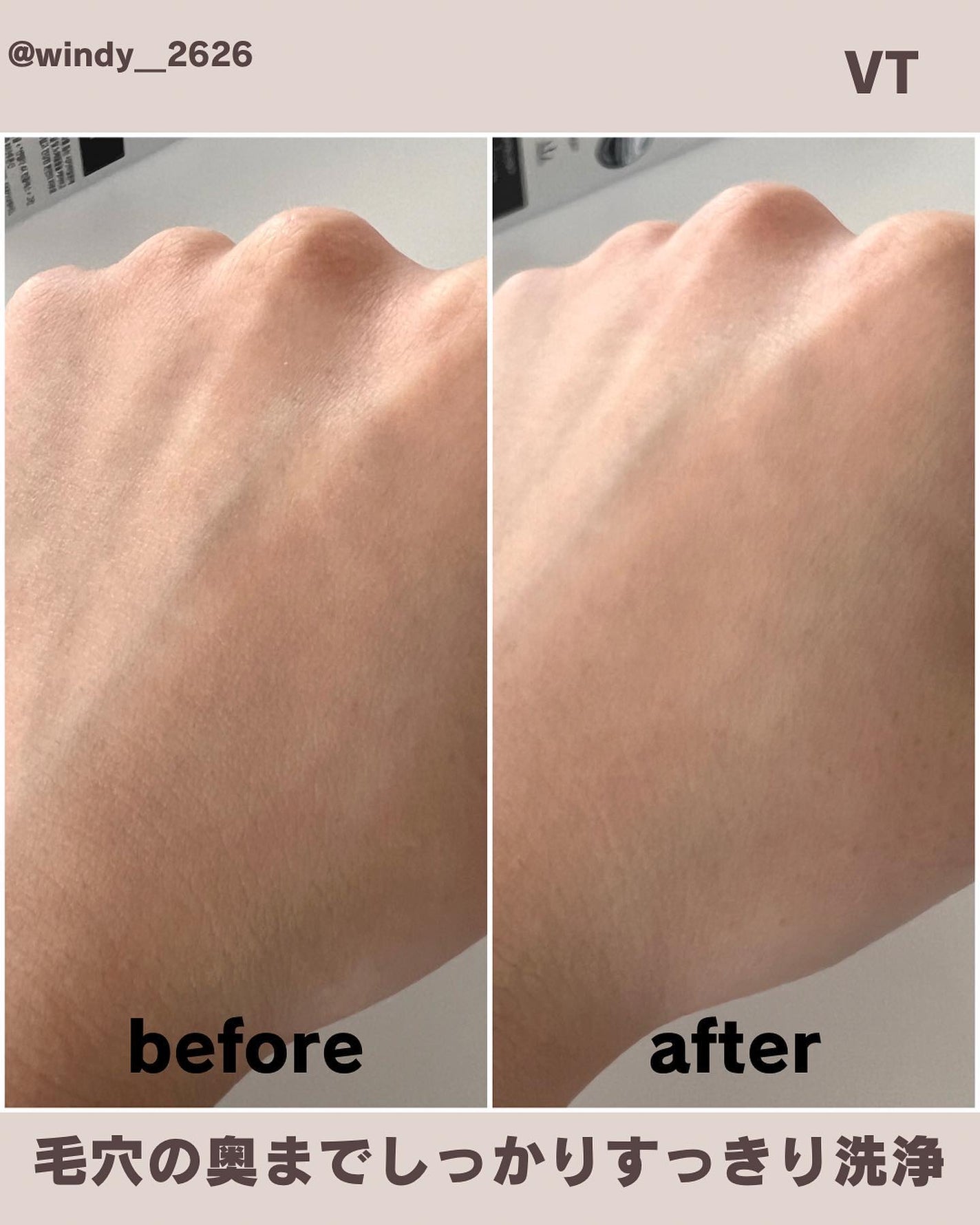 リードルショットシナジースパークリングトナー/VT/化粧水を使ったクチコミ(4枚目)