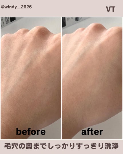 リードルショットシナジースパークリングトナー/VT/化粧水を使ったクチコミ(4枚目)