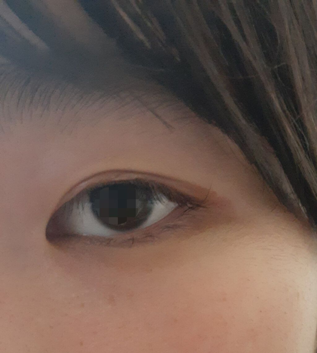 アイビューティー フィクサー WP/アストレア ヴィルゴ/二重まぶた用アイテムを使ったクチコミ（2枚目）