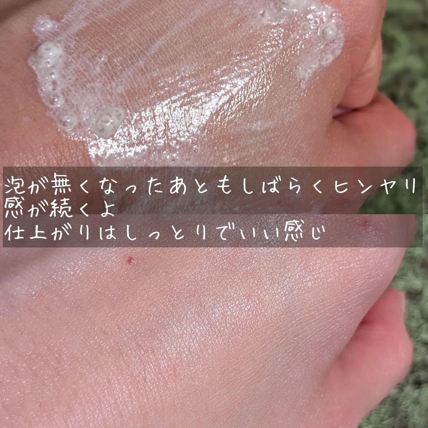 スターライトuvゴルフパッチ/uvcare/日焼け止めローションを使ったクチコミ(5枚目)