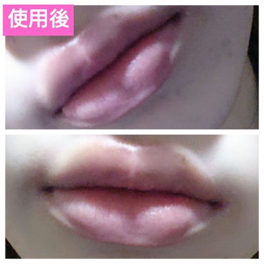 plump it volumising  lip plumper/Plump It!/リップケア・リップクリームを使ったクチコミ（3枚目）