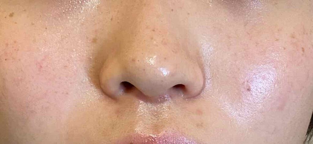 なさ on LIPS 「肌改善計画7日目こんばんは☆なさです💓今日も肌改善計画やってい..」(3枚目)