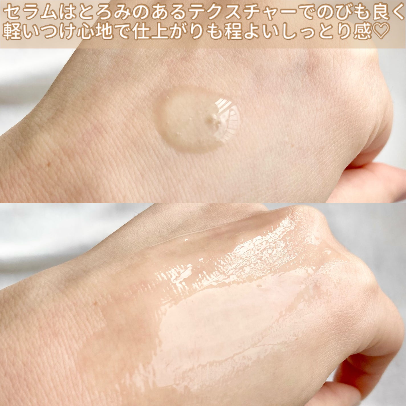 グリーンカーミングセラムミスト/Free Moment /ミスト状化粧水を使ったクチコミ(6枚目)