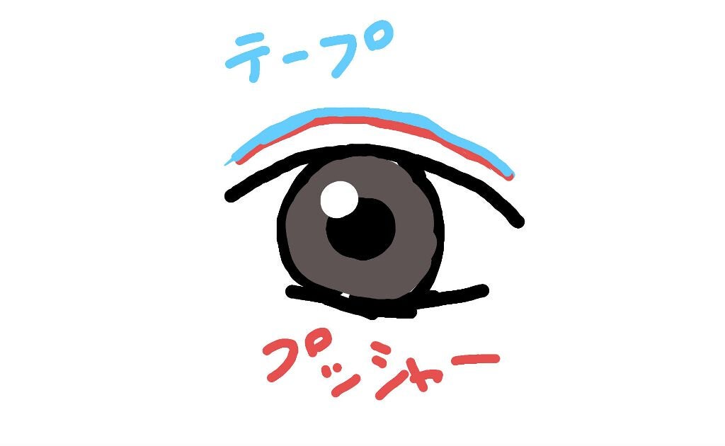 アイテープ 埋没式両面テープ/DAISO/二重まぶた用アイテムを使ったクチコミ(2枚目)