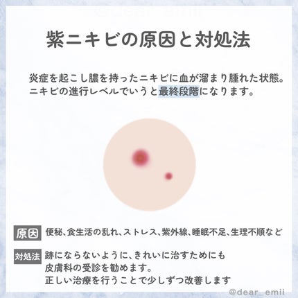 emii パーソナルカラー on LIPS 「【予防&改善】対処法を知って一緒治そう🗒️ニキビの種類+原因+..」(9枚目)