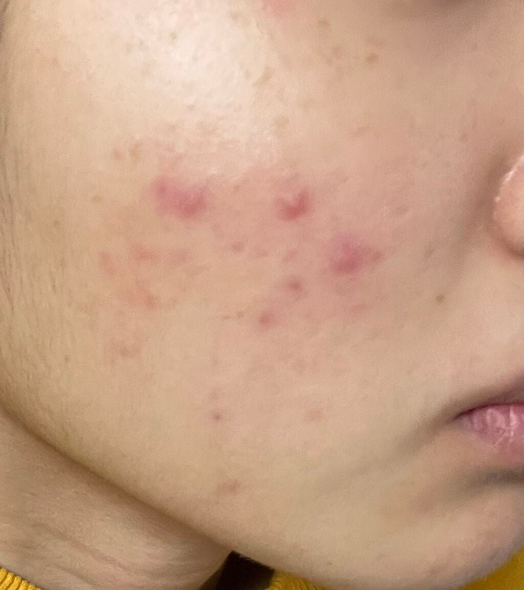 潤浸保湿 フェイスクリーム/キュレル/フェイスクリームを使ったクチコミ(1枚目)