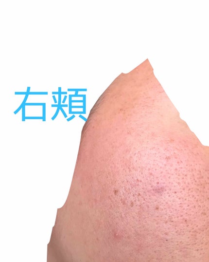 ハトムギ化粧水(ナチュリエ スキンコンディショナー R )/ナチュリエ/化粧水を使ったクチコミ(3枚目)