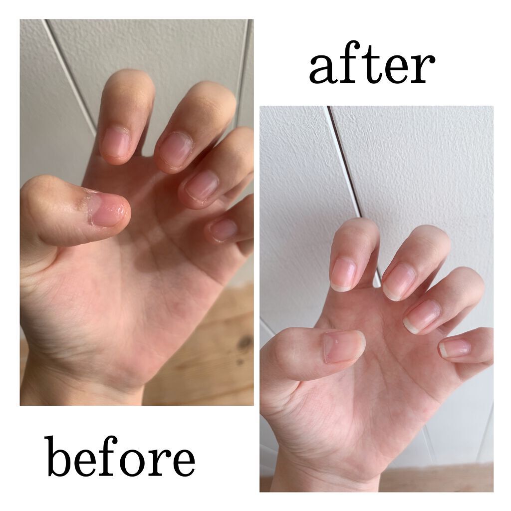 ディーアップファンデーション/D-UP/ネイルベースコートを使ったクチコミ（1枚目）