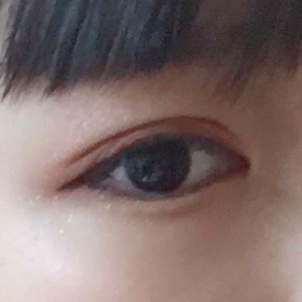 オードムーゲ 薬用ローション（ふきとり化粧水）/オードムーゲ/拭き取り化粧水を使ったクチコミ（3枚目）