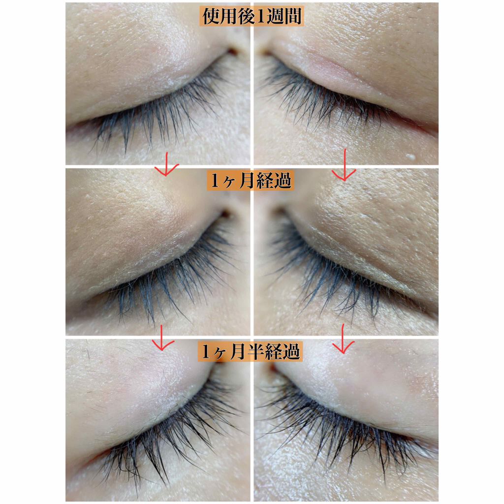 EMAKED（エマーキット）/水橋保寿堂製薬/まつげ美容液を使ったクチコミ（3枚目）