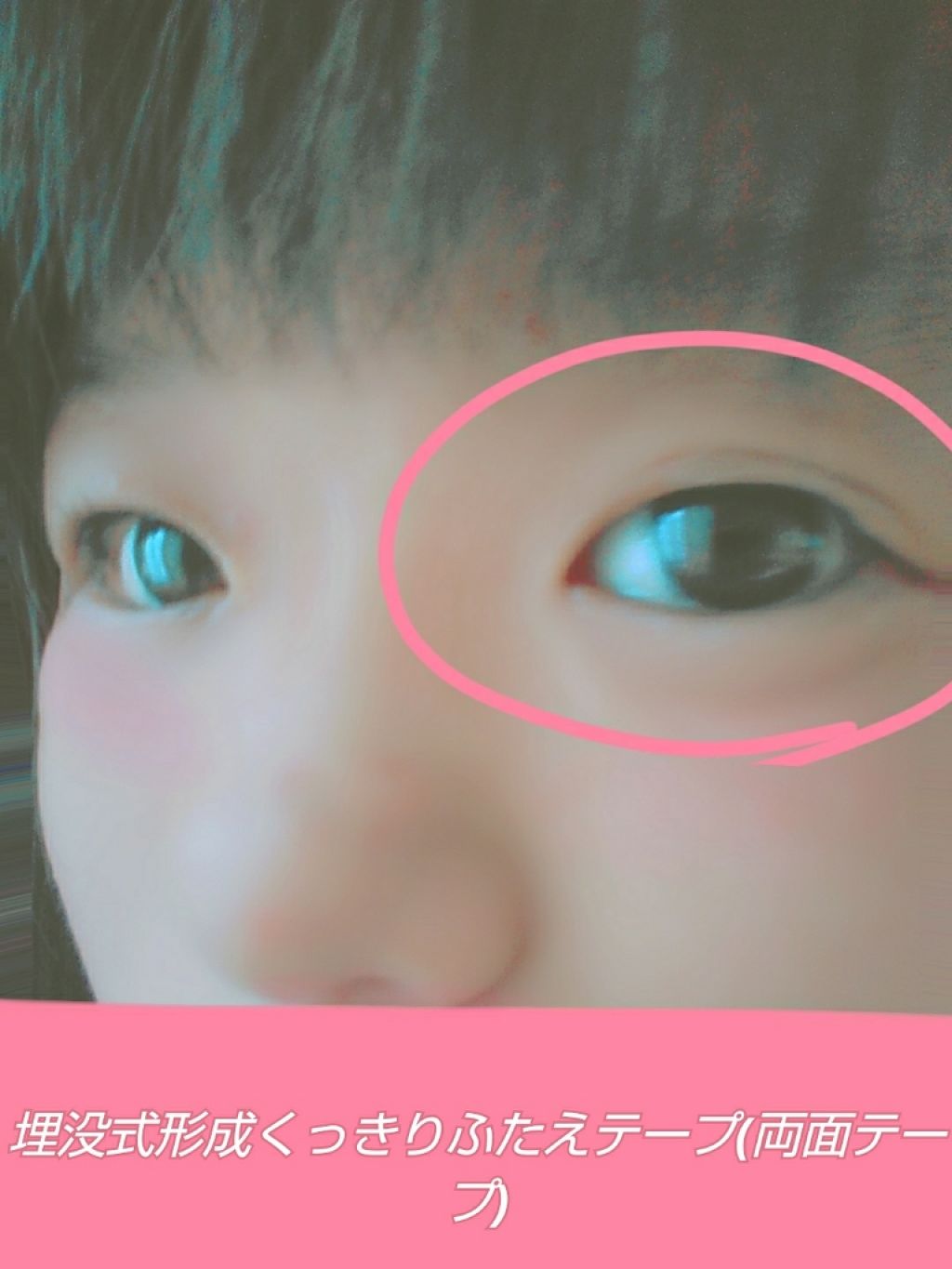 のびーるアイテープ(絆創膏タイプ、レギュラー)/DAISO/二重まぶた用アイテムを使ったクチコミ(4枚目)