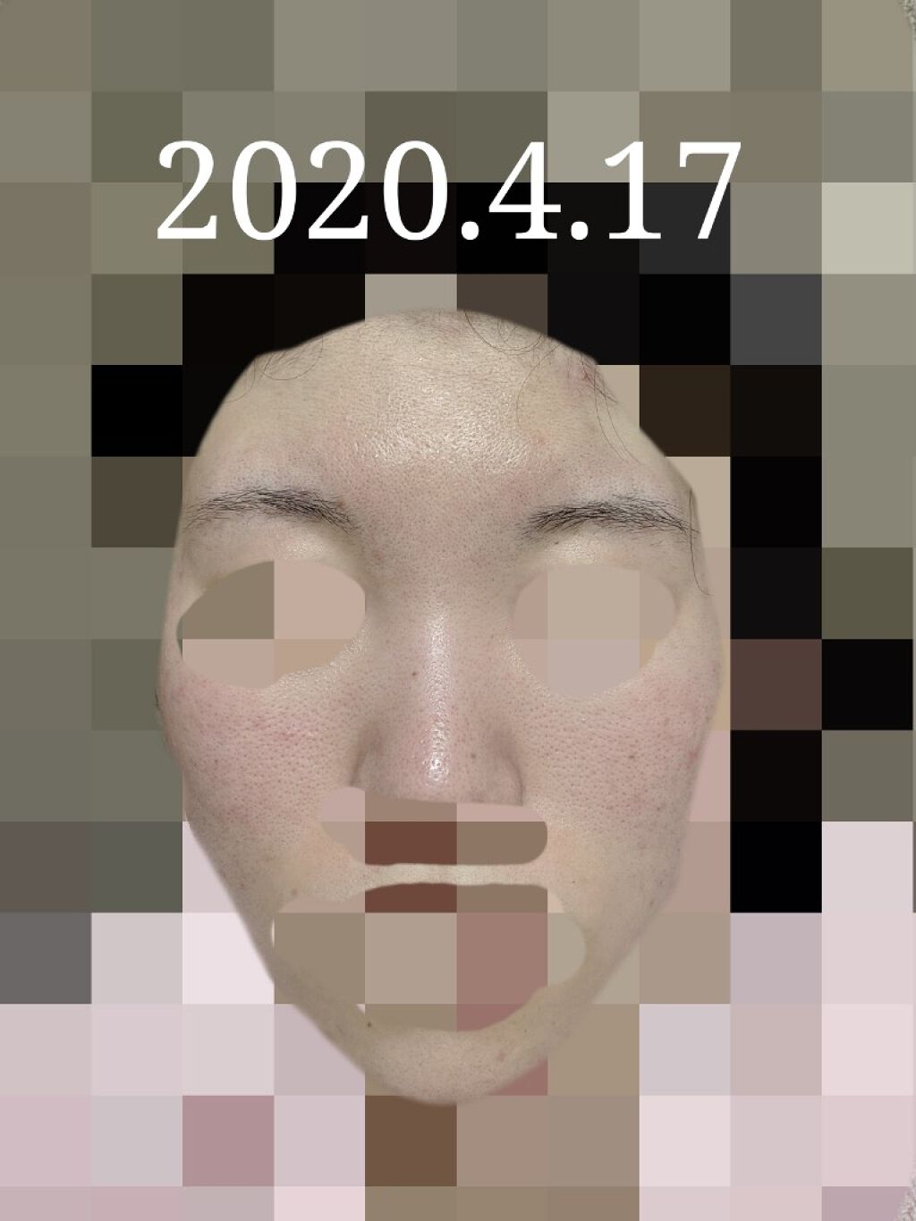 エバレッシュホワイトEXⅡ(医薬品)/matsukiyo/その他を使ったクチコミ（1枚目）