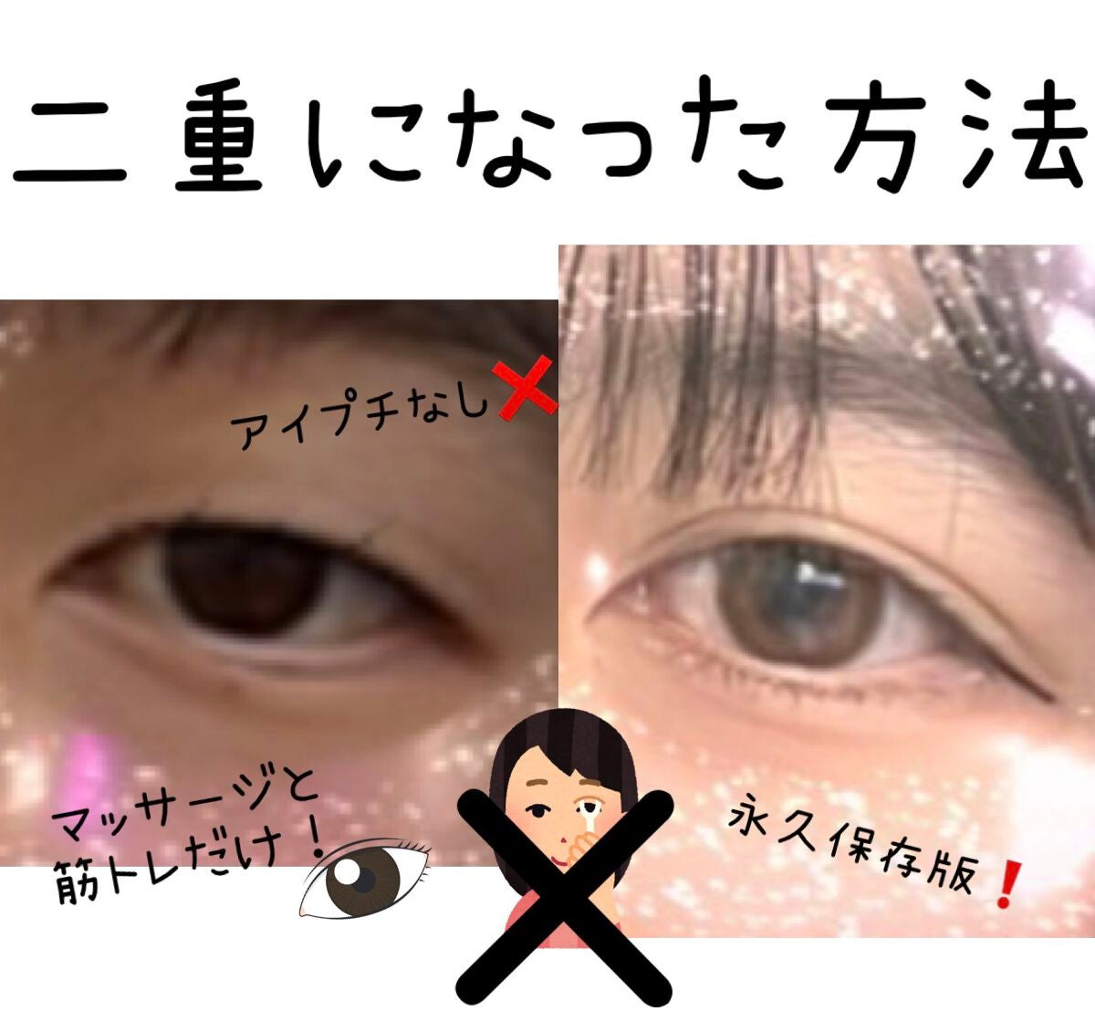 カワイクなりたい🎀フォロバ100% on LIPS 「みなさんお久しぶりです💦今回は私が一重から二重になった方法を紹..」(1枚目)