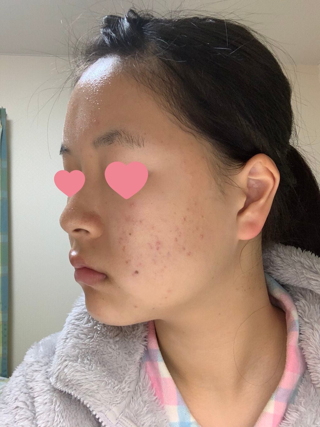 薬用保湿化粧水/オードムーゲ/化粧水を使ったクチコミ(2枚目)