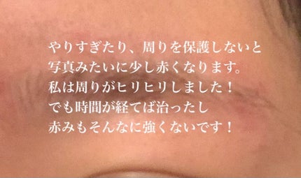 除毛クリームキット敏感肌用/エピラット/除毛クリームを使ったクチコミ(4枚目)