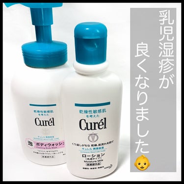 キュレルにかえてから
子の乳児湿疹が良くなりました💡
以来、ずっと愛用しています✨

二人目を妊娠中、
妊娠中や小さい子がいる時にしか
応募できないプレゼント企画に
片っ端から応募していていました😂
そこで見事こちらの2点セットが当選し
頂いたのがきっかけ。

当初は、既にパルシステムで購入していた
ベビーソープを使っていました。

合ってないのか次第に肌が荒れる我が子…🥲

そこで、そういえば！と
保管していたキュレルに切り替えてみると
だんだんと改善されていきました。

光の当たり具合や角度が違うので
比較が難しいですが
2枚目の写真がビフォーアフターです。

それからは子どものスキンケアでは
ずっとキュレルを愛用しています🙌

乳児湿疹に悩まれてるお母さんは
一度検討しても良いかもしれません。

そして！
妊娠中や小さい子がいる時のみ応募できる
プレゼント企画は
結構当たりやすいのでおすすめです！！

他にもおもちゃ等いくつか当選しました☺️✨

✼••┈┈••✼••┈┈••✼••┈┈••✼••┈┈••✼
#キュレル #ローション #泡ボディウォッシュ #乳児湿疹 #保湿 #懸賞 #スキンケア #キュレル_乳液 #キュレル_ニキビ #キュレル_皮脂トラブル #スキンケアトークの画像 その0