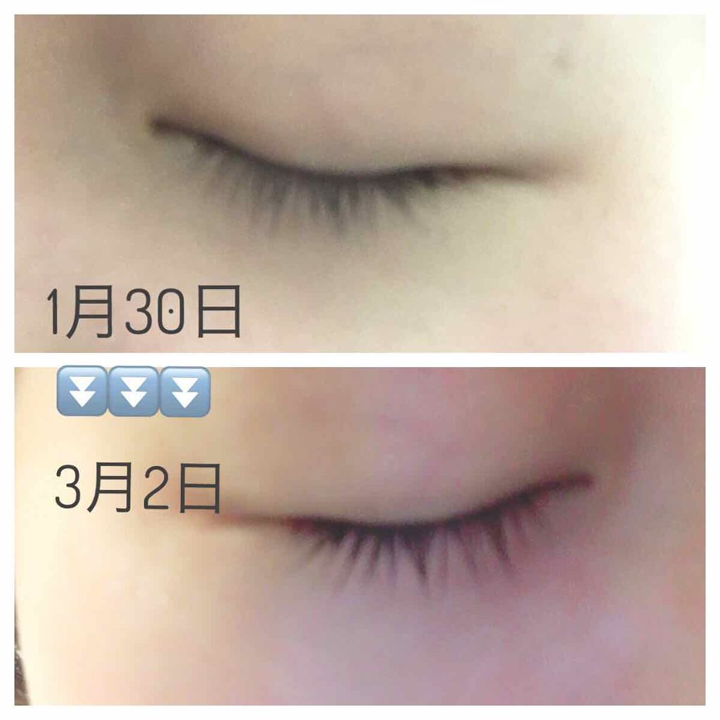 リバイタラッシュ アドバンス ジャパン/エム・アール・アイ/まつげ美容液を使ったクチコミ(1枚目)
