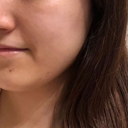 SUIKO HC シカバリアマスク/SUIKO HATSUCURE/シートマスク・パックを使ったクチコミ(9枚目)