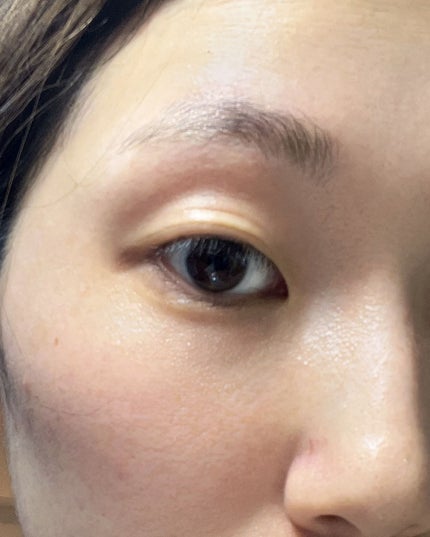 TWOOL ダブルアイリッドグルー/SHOBIDO/二重まぶた用アイテムを使ったクチコミ(3枚目)