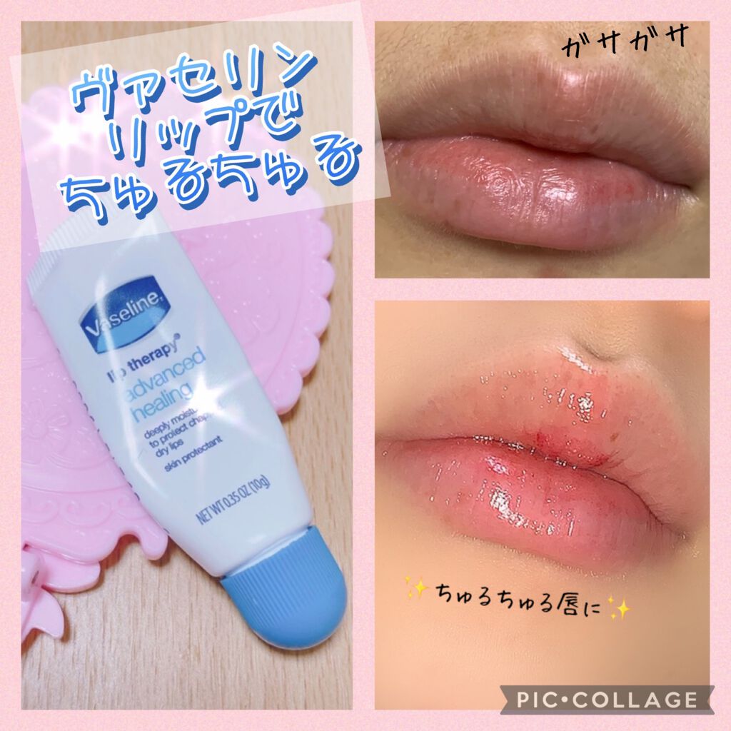 ペトロリューム ジェリー リップ レギュラー/ヴァセリン/リップクリームを使ったクチコミ(1枚目)
