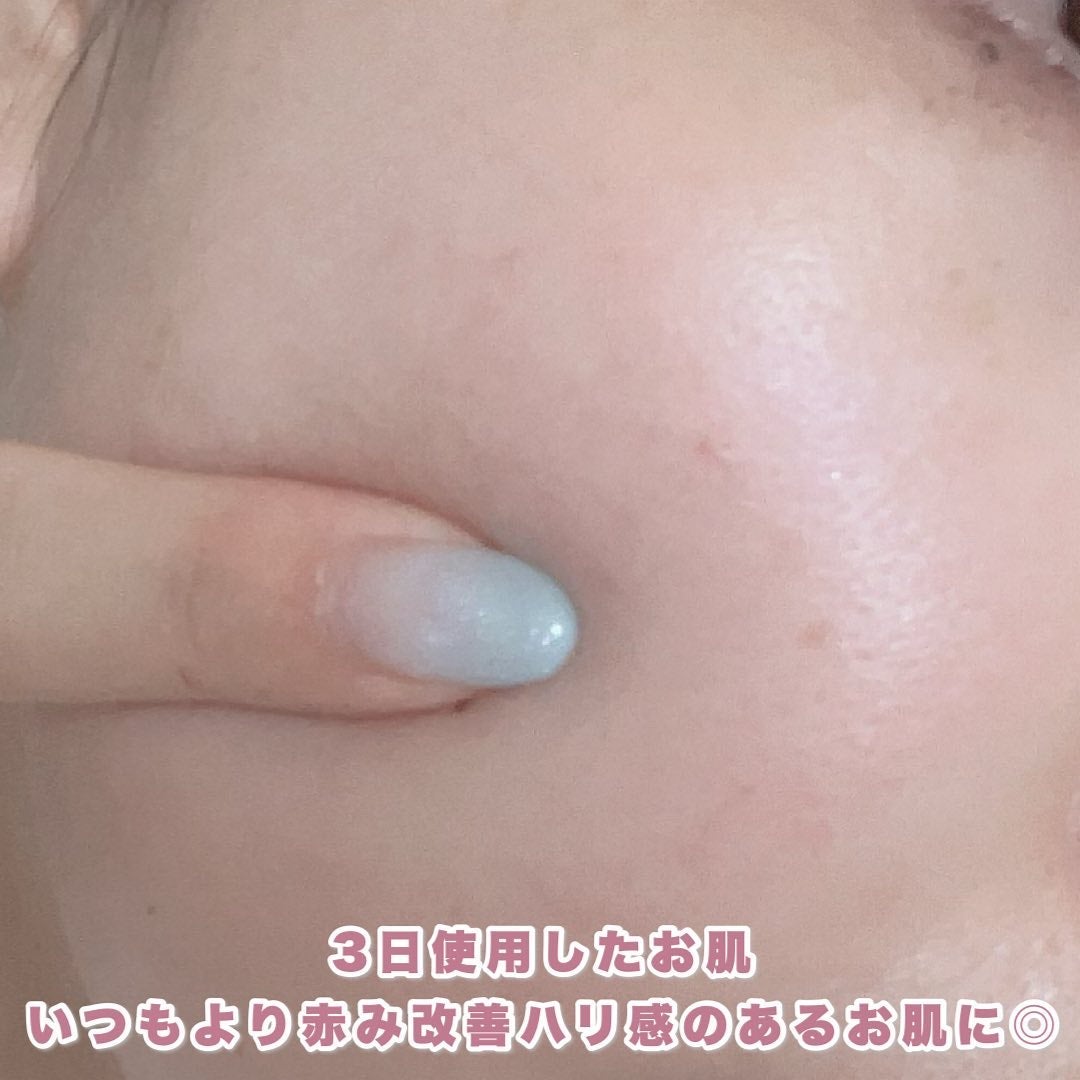 リードルショット100/VT/美容液を使ったクチコミ(4枚目)