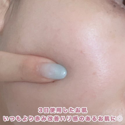 リードルショット100/VT/美容液を使ったクチコミ(4枚目)