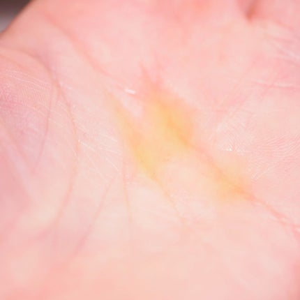 アドバンスド ビタC トーニング セラム14.5/リエンジャン/美容液を使ったクチコミ(4枚目)