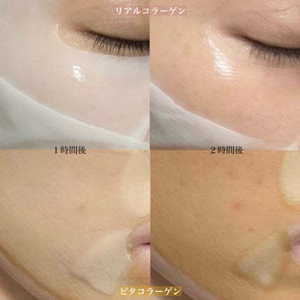 パーフェクト リアル パフォーマンス コラーゲンマスクパック /ダーマフィックス/シートマスク・パックを使ったクチコミ(6枚目)