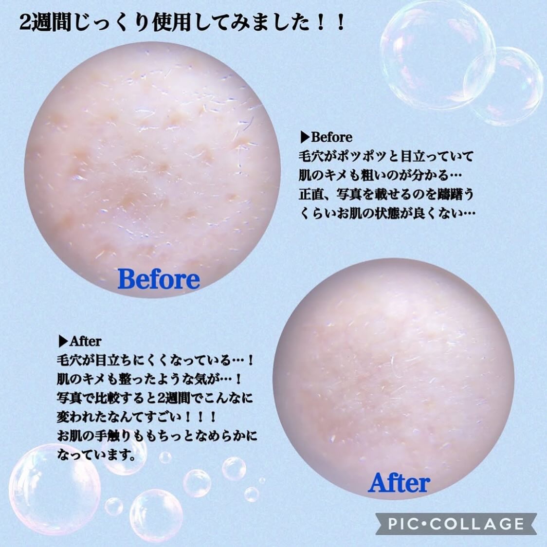 PDRN+ デイリーマスク/VT/シートマスク・パックを使ったクチコミ（3枚目）