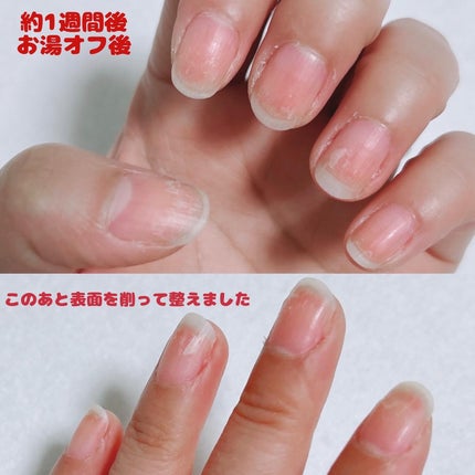 パルP ワンステップピールオフジェル/parkikoi/ジェルネイルを使ったクチコミ(8枚目)