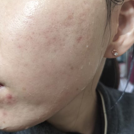 を使ったクチコミ(2枚目)