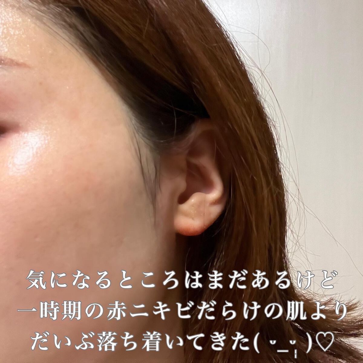 ブライトクリーン/YA-MAN TOKYO JAPAN/美顔器・マッサージを使ったクチコミ（3枚目）