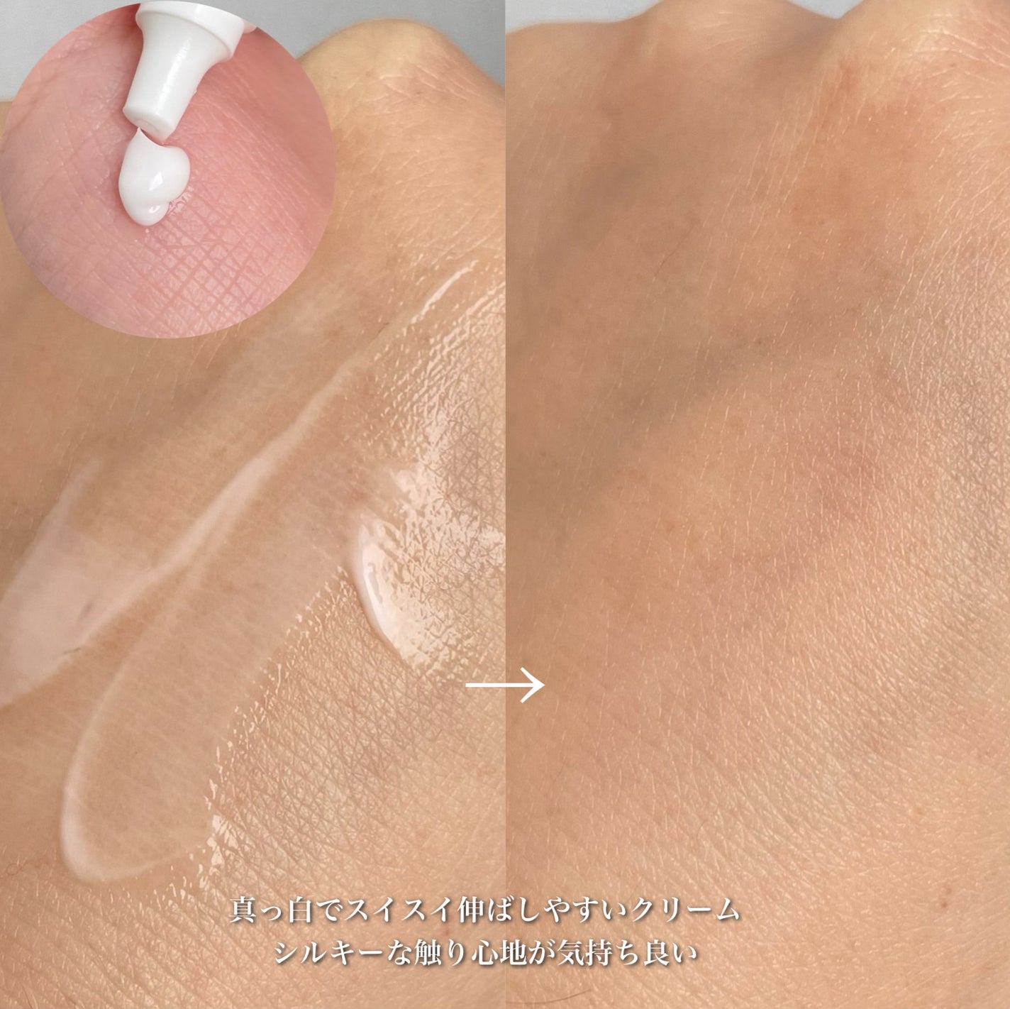 ノスカナイン トラブル セラム/FATION/美容液を使ったクチコミ(8枚目)