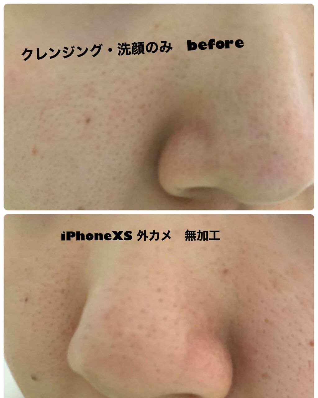 ガスール固形/ナイアード/洗顔石鹸を使ったクチコミ（2枚目）