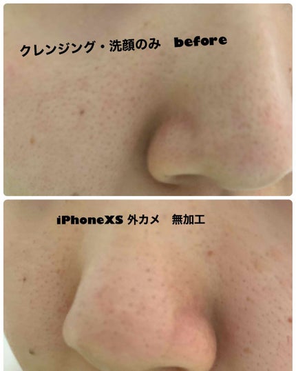 ガスール固形/ナイアード/洗顔フォームを使ったクチコミ(2枚目)