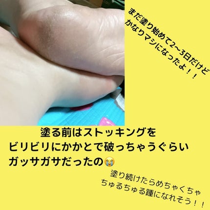 メディカルクリームG(薬用クリームG)/メンターム/ハンドクリームを使ったクチコミ(5枚目)