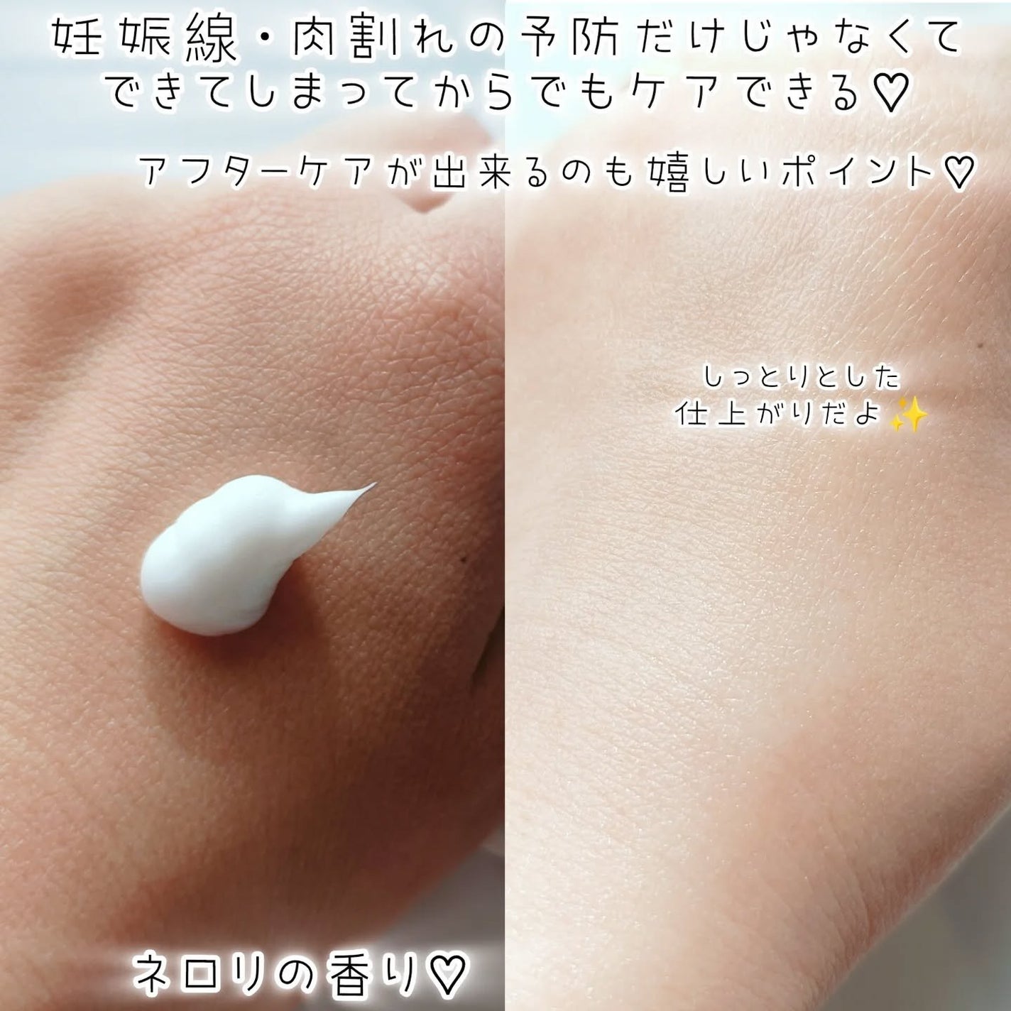 ノコア アフターボディ トリートメントクリーム/NOCOR/ボディクリームを使ったクチコミ(2枚目)