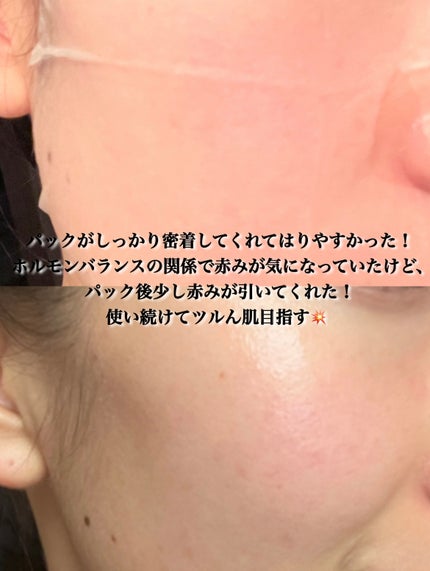 シカレチA セブンデイズマスク/VT/シートマスク・パックを使ったクチコミ(4枚目)