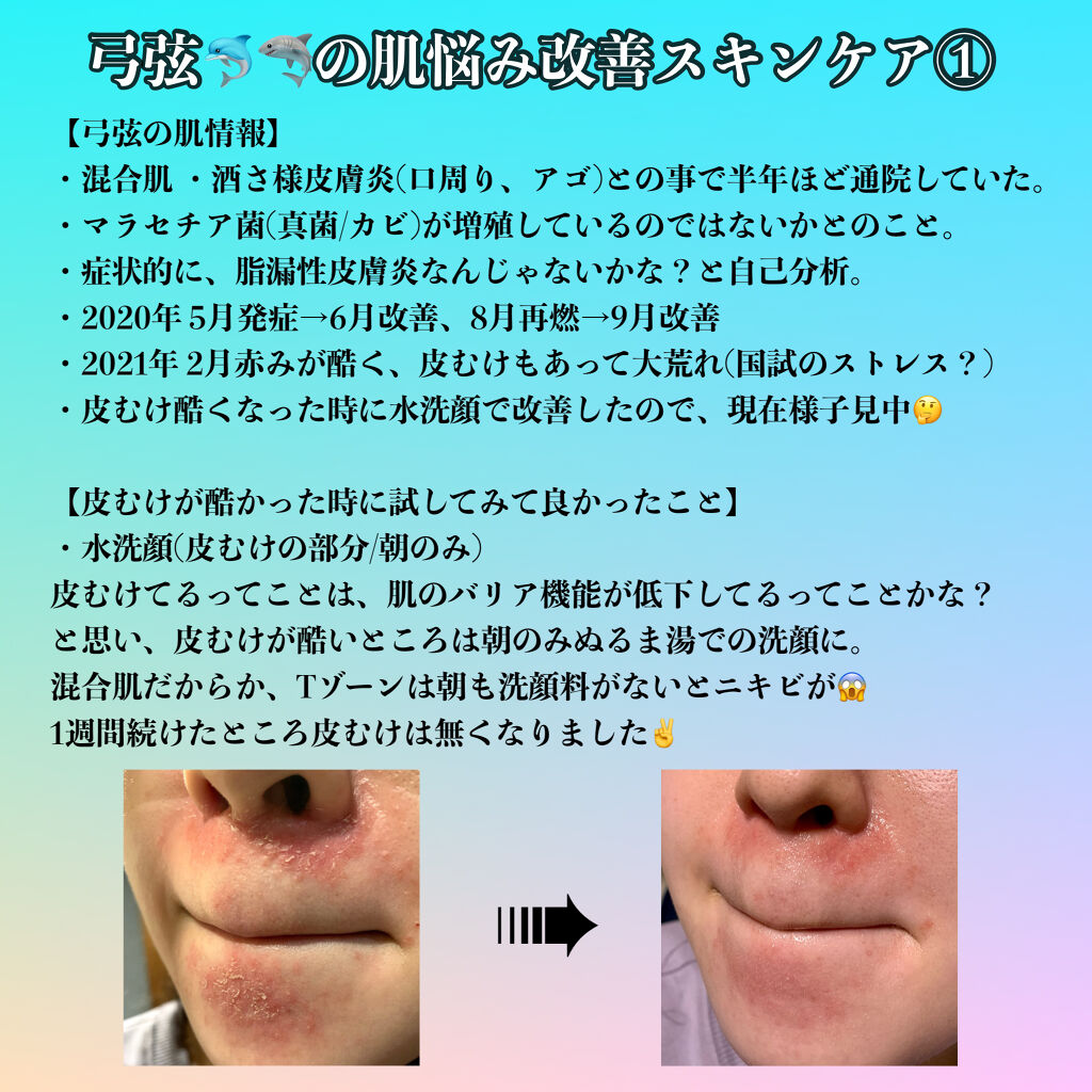 コラージュフルフル 泡石鹸/コラージュフルフル/デリケートゾーンケアを使ったクチコミ（1枚目）