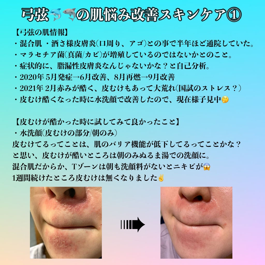 コラージュフルフル 泡石鹸/コラージュ/デリケートゾーンケアを使ったクチコミ(1枚目)